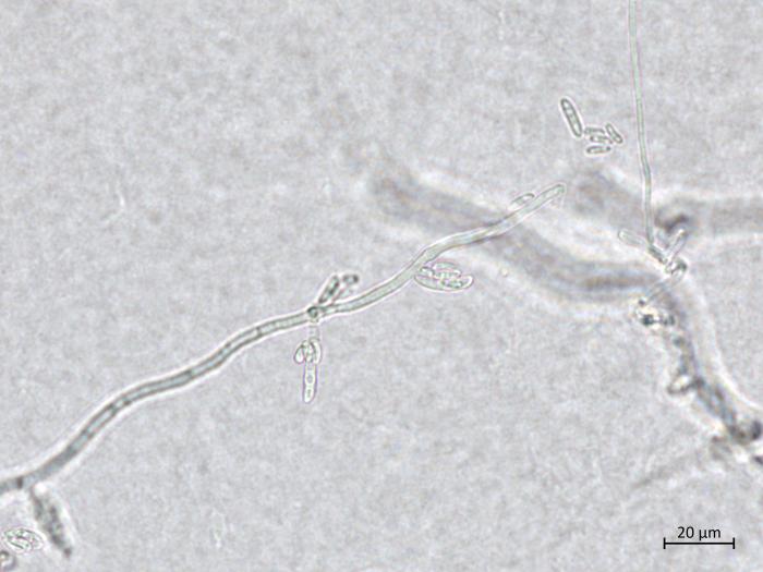 Neocosmospora_phaseoli_6