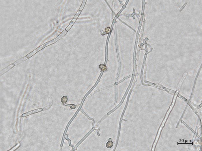 Neocosmospora_phaseoli_7