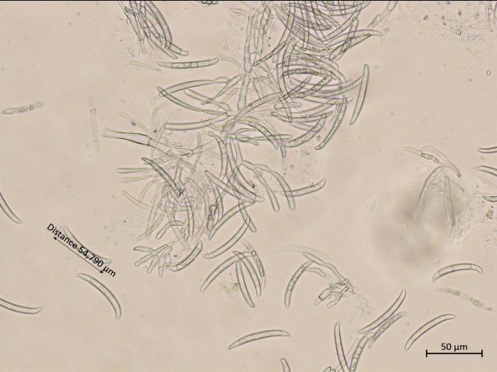 Neocosmospora_phaseoli_9