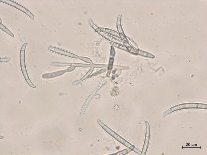 Neocosmospora_phaseoli_10