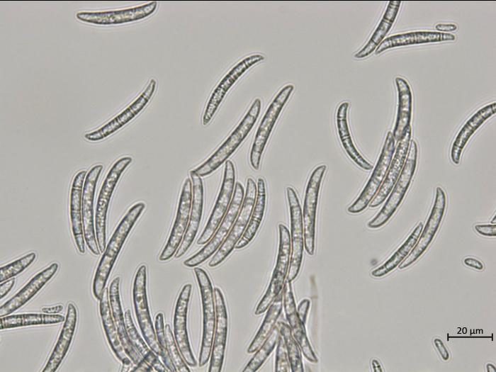 Neocosmospora_pisi_1