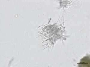 Phyllachora_maydis_3