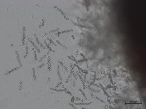 Phyllachora_maydis_4