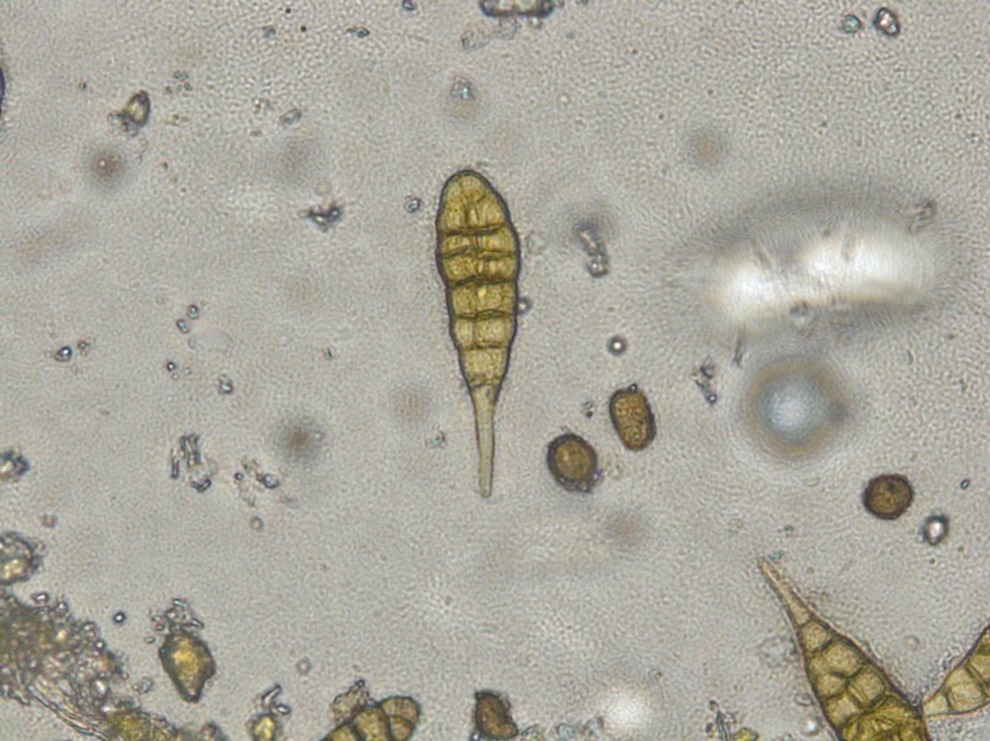 Alternaria porri_55604-2