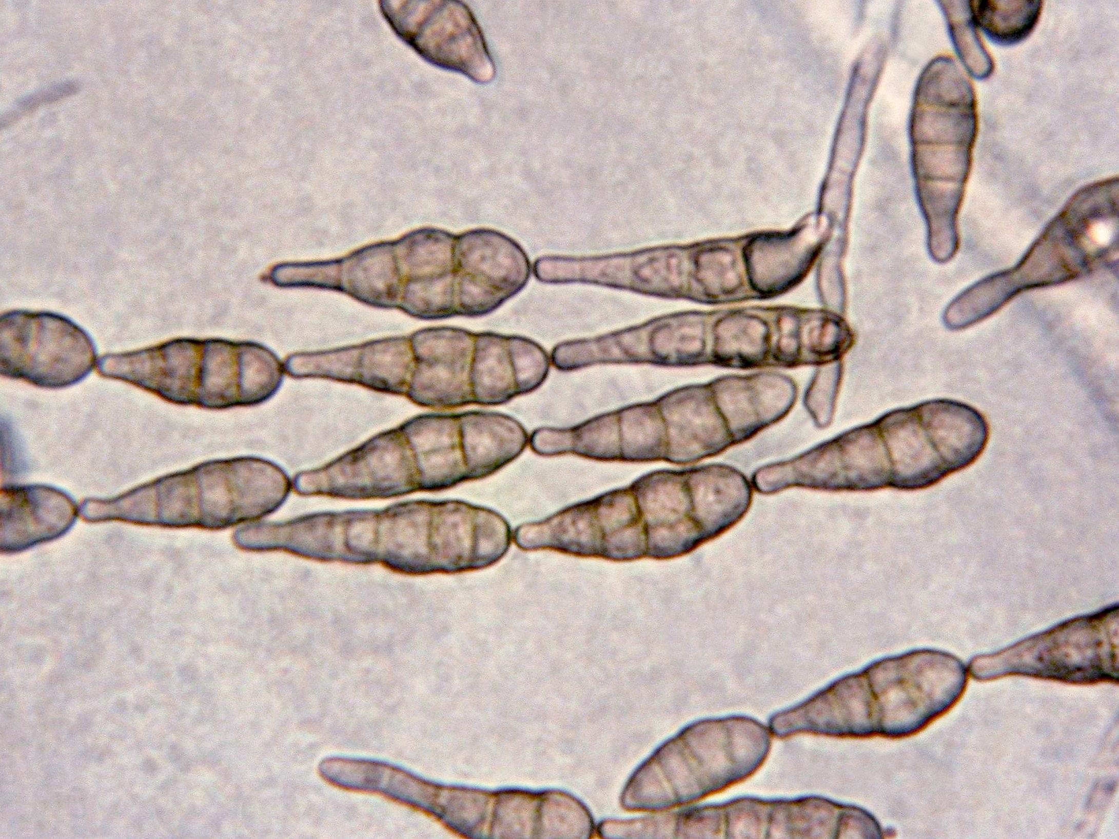 Alternaria_alternata-03_LQ