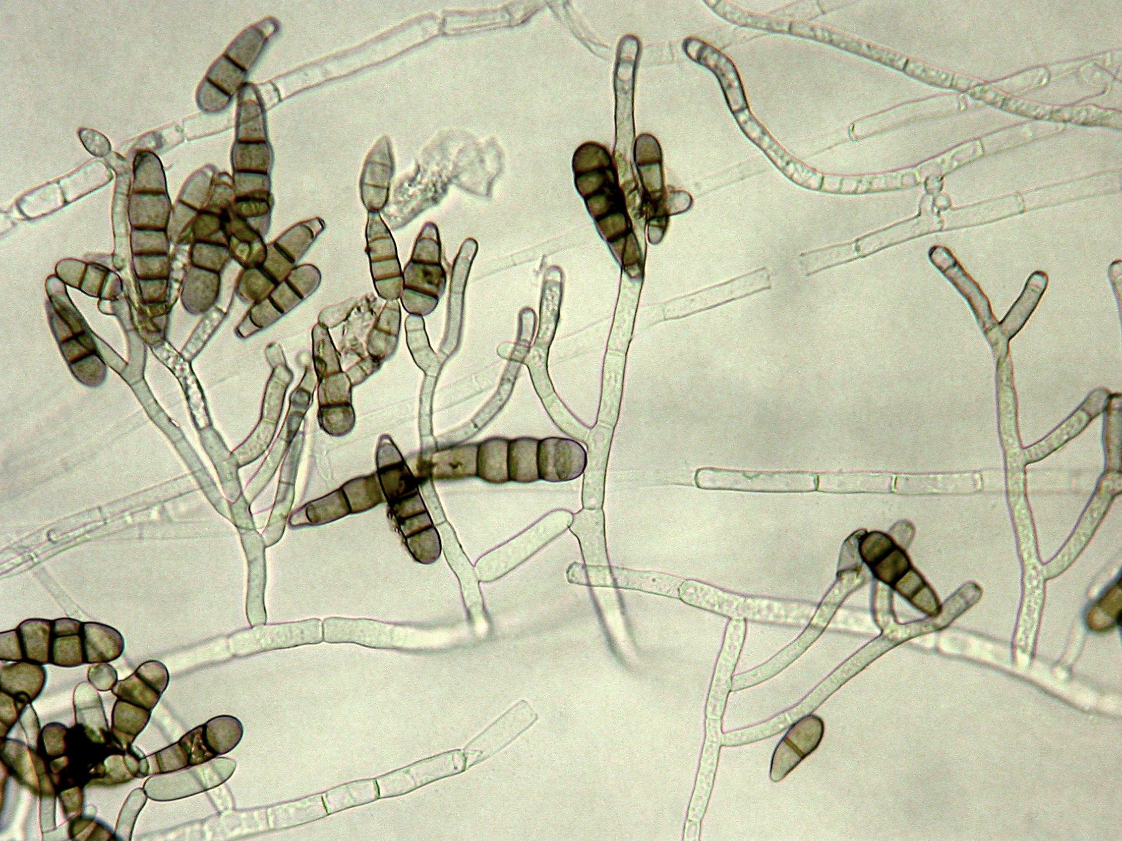 Alternaria_brassicicola-04_LQ