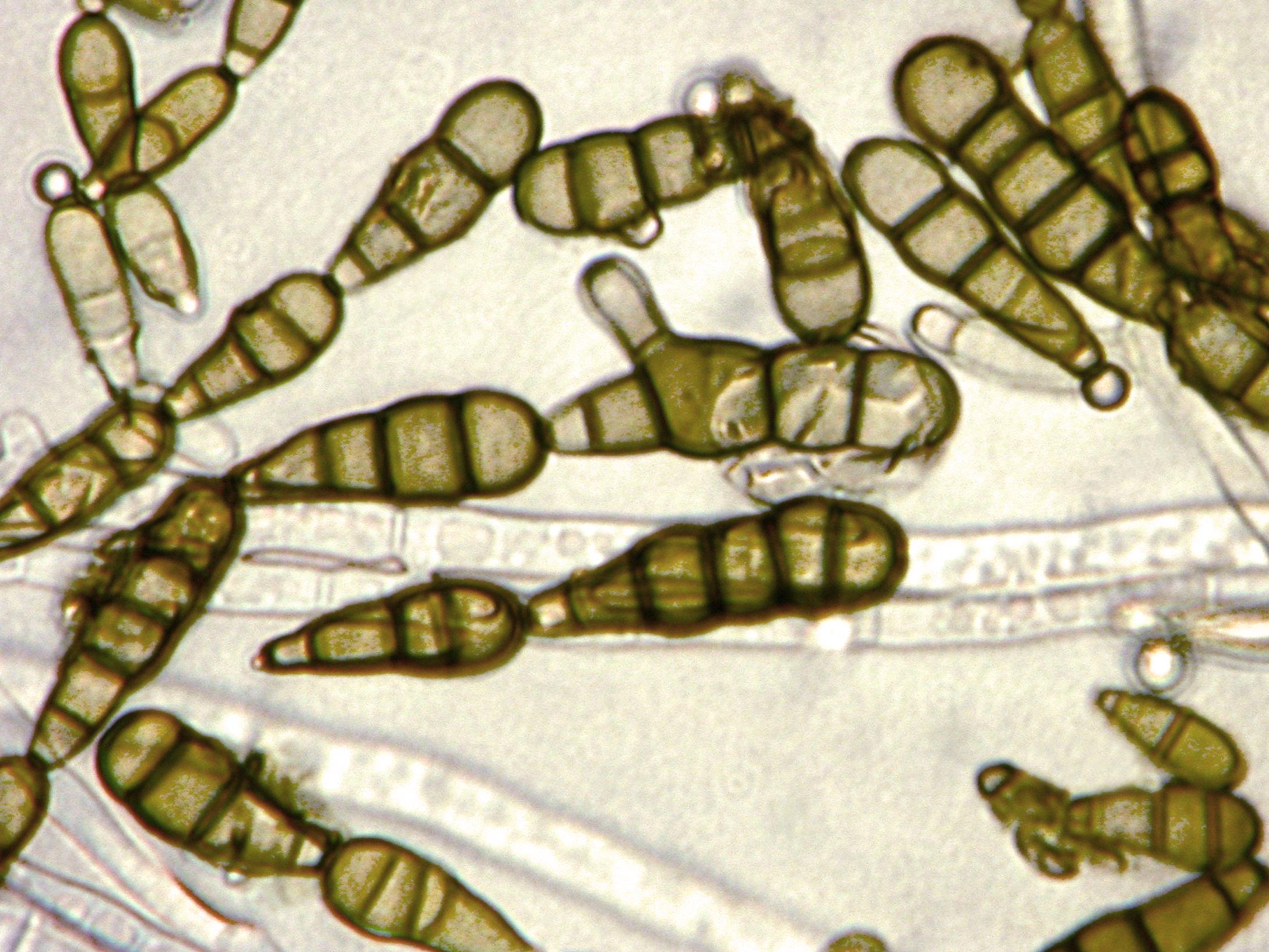 Alternaria_brassicicola-07_LQ