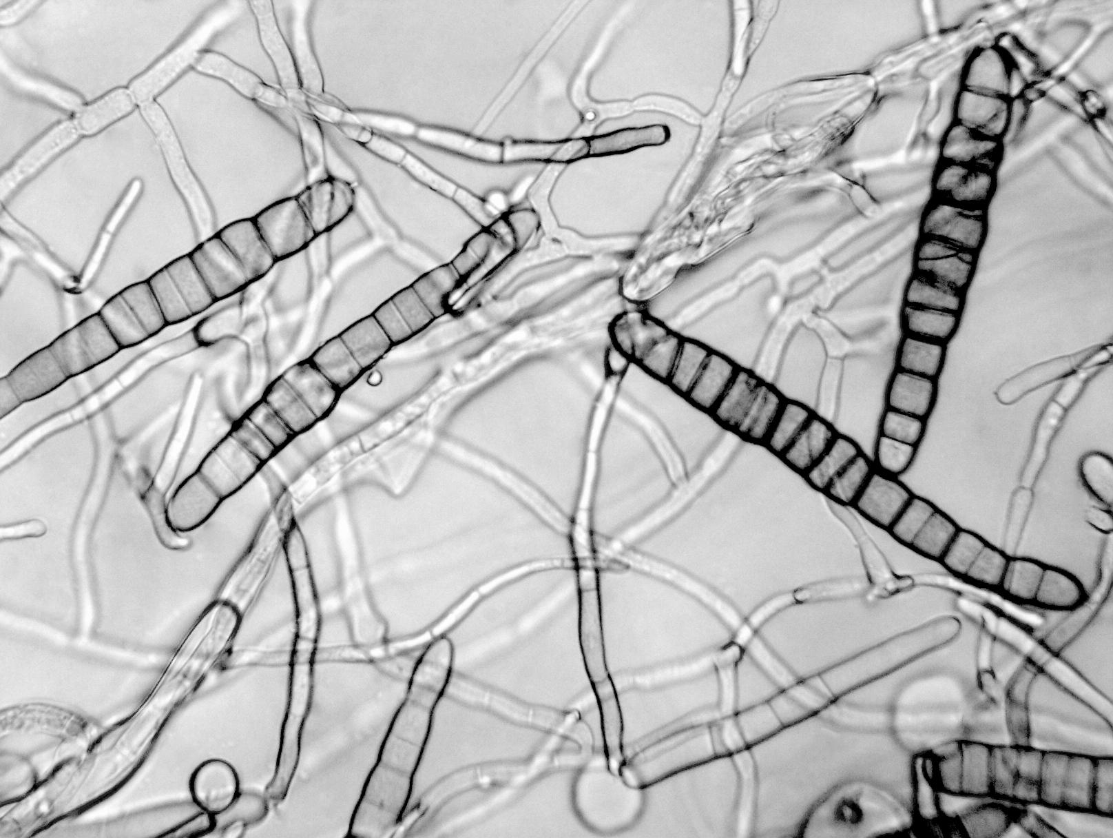 Alternaria_chrysanthemi-02_LQ