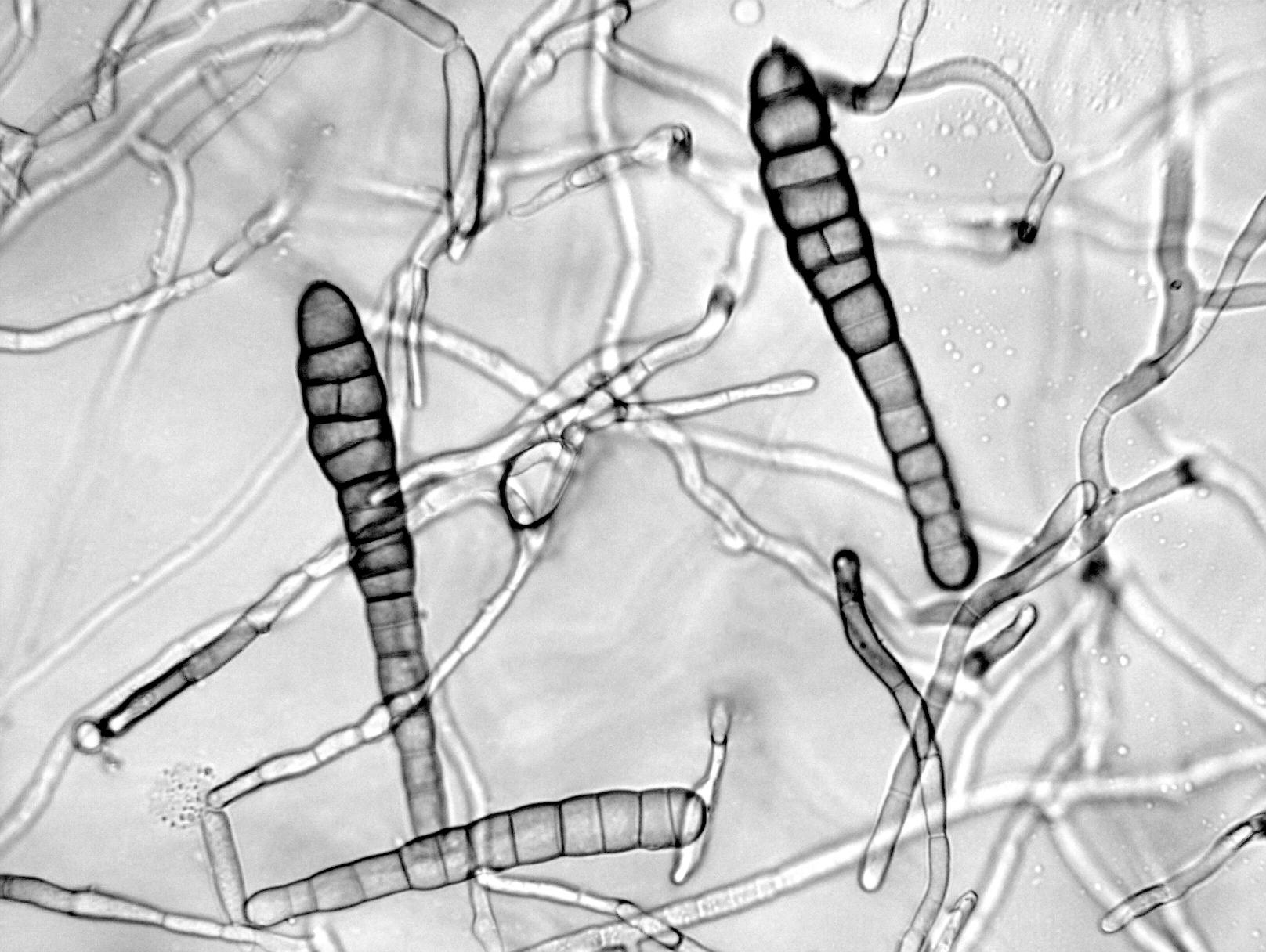 Alternaria_chrysanthemi-03_LQ