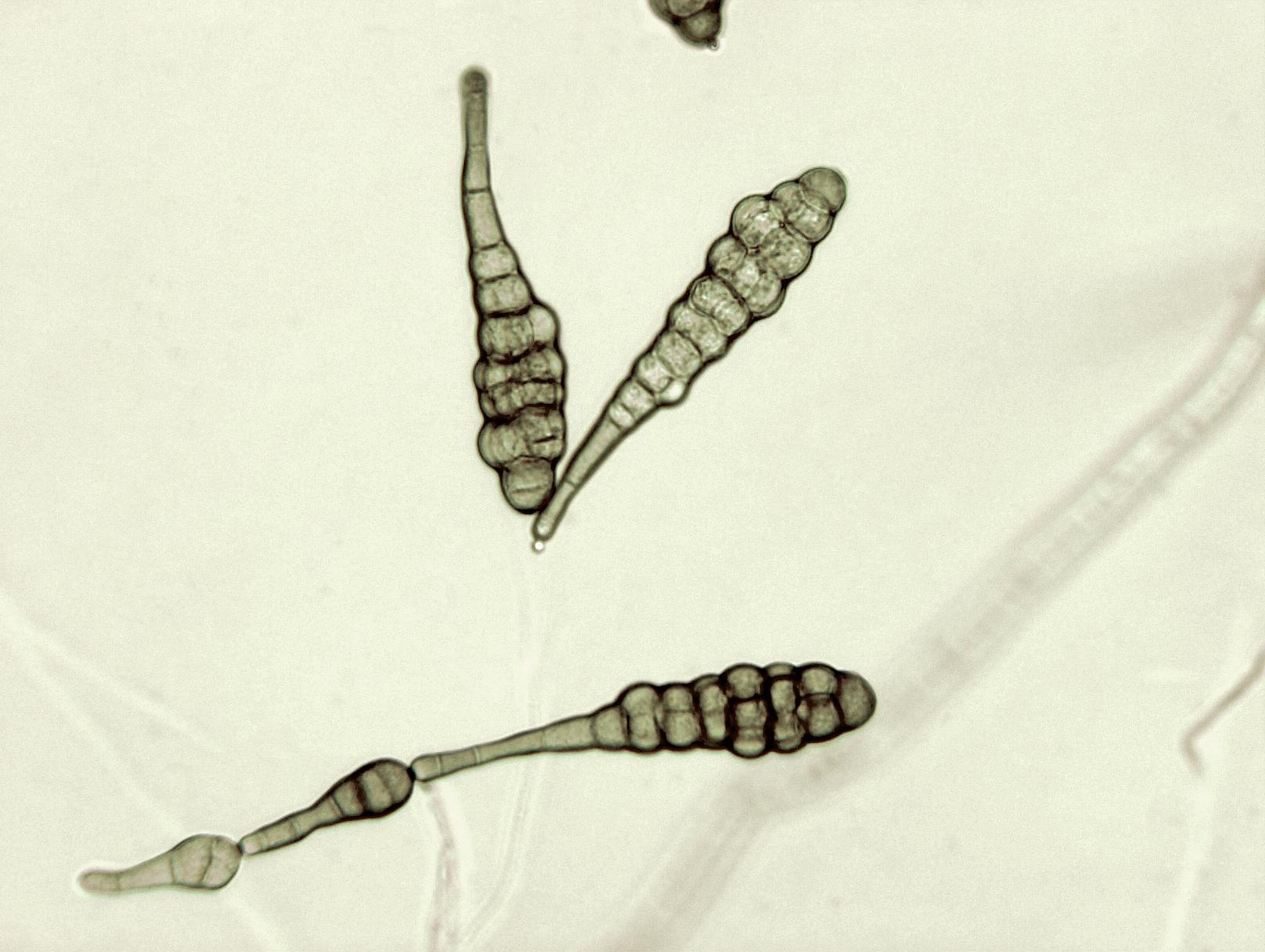 Alternaria_panax-05_LQ