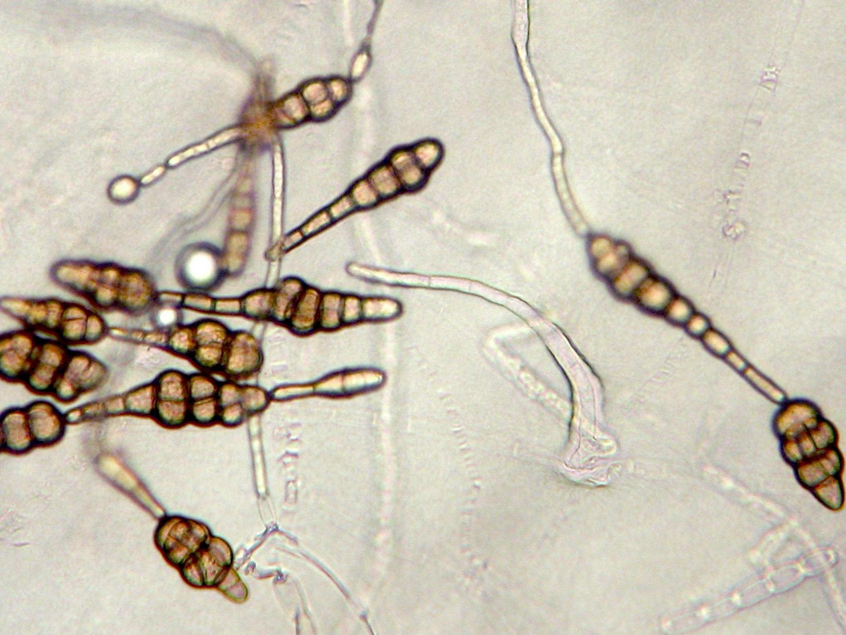 Alternaria_radicina-02_LQ