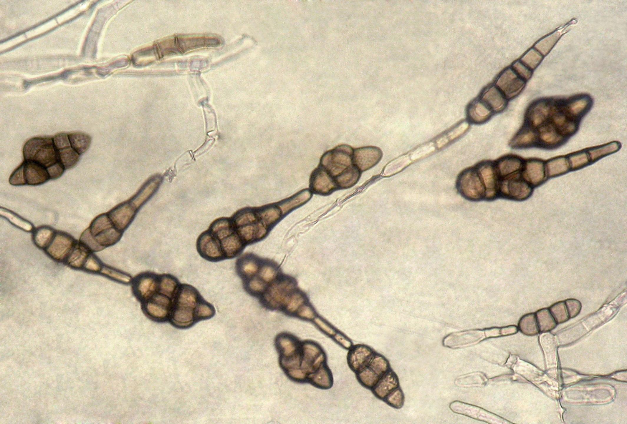 Alternaria_raphani_04_LQ.jpg