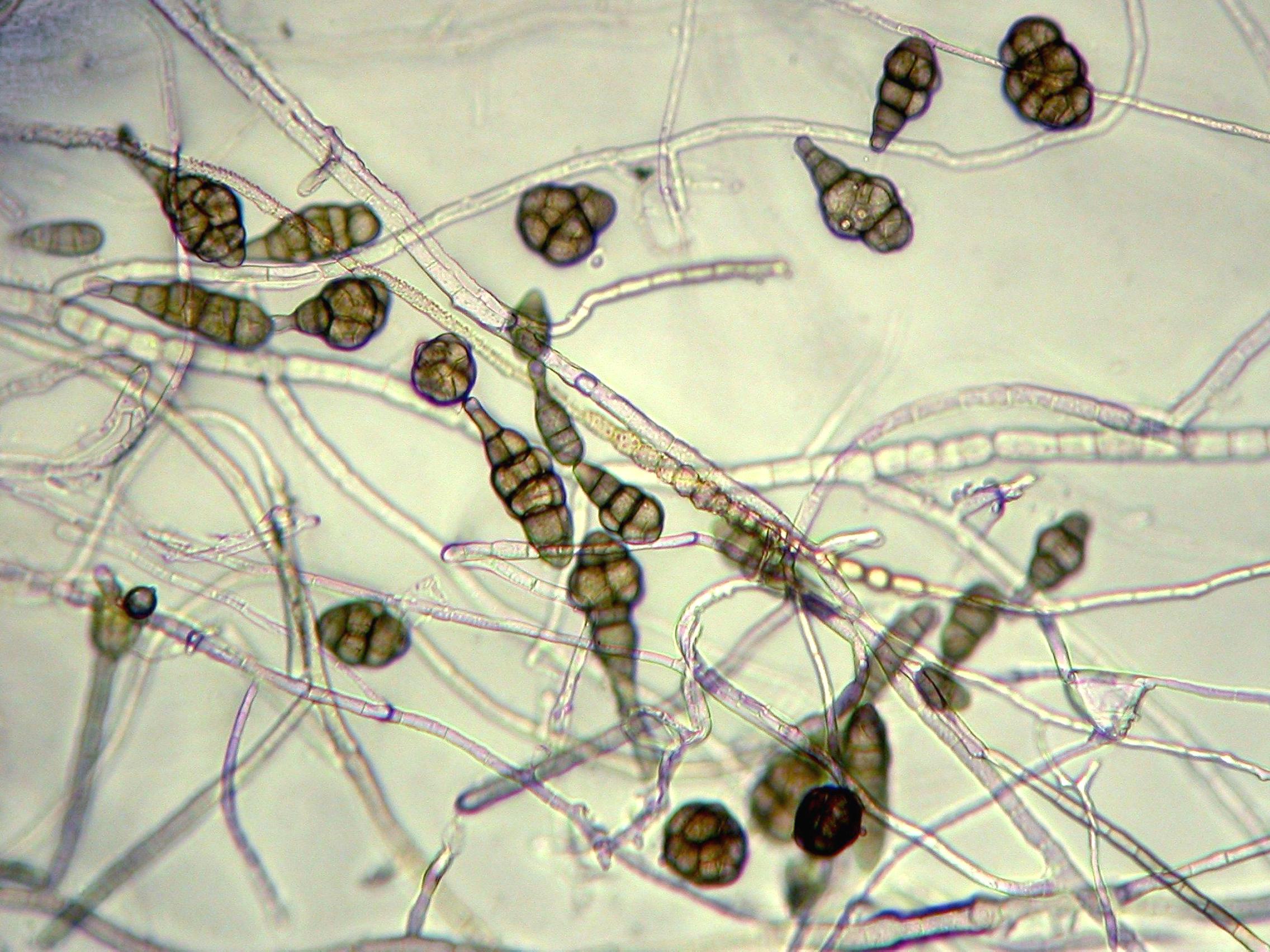 Alternaria_saponariae-01_LQ