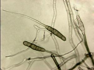 Alternaria_solani-05_LQ