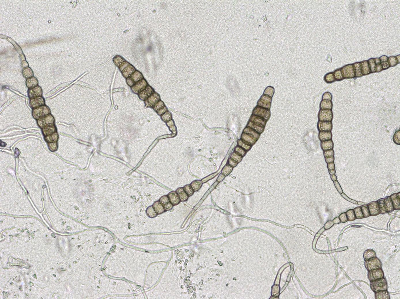 Alternaria_solani_D53639_B_LQ.jpg