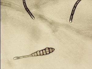 Alternaria_tagetica-01_LQ