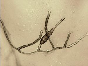 Alternaria_tagetica-03_LQ