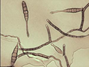 Alternaria_tagetica-06_LQ