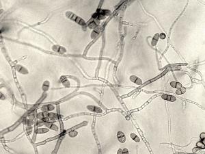 Cladosporium_phlei-01