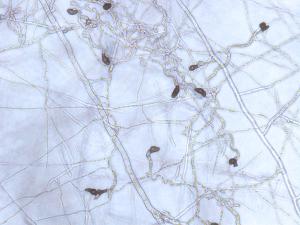 Colletotrichum_Appressoria_D50604-2_LQ