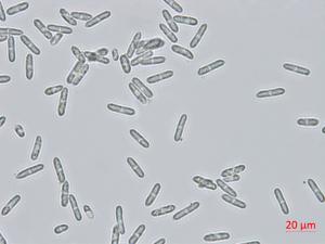 Colletotrichum_coccodes_D35079-3_LQ