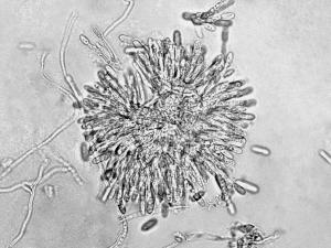 Colletotrichum_gloeosporioides-02