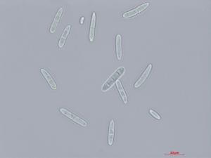 Cylindrocarpon_D27080-1_LQ