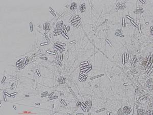 Cylindrocarpon_D27080-2_LQ