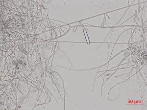 Cylindrocarpon_D44139_LQ