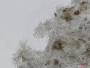 Cytospora_leucostoma_D44677-1_Conidiophores_LQ