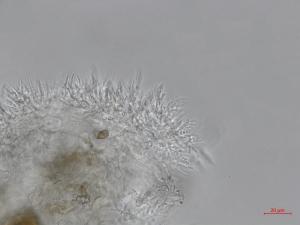 Cytospora_leucostoma_D44677-2_Conidiophores_LQ