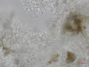 Cytospora_leucostoma_D44677-3_Conidiophores_LQ