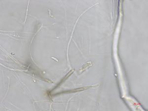 Dictyochaeta_D34357-2_LQ