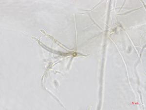 Dictyochaeta_D34357-3_LQ