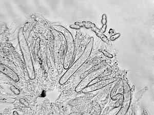 Didymella_applanata_1