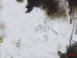 Diplodia_seriata_D43390-1_Cellules_conidio_LQ