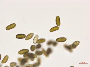 Diplodia_seriata_D43390-2_Conidies_LQ