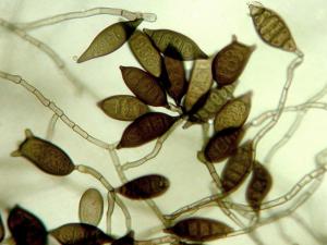 Exserohilum pedicellatum-01-ret