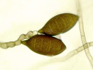 Exserohilum pedicellatum-04-ret