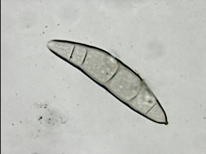 Exserohilum turcicum-ret-08