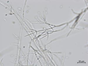 Gibellulopsis_sp_1
