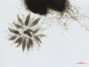 Physalospora_sp_1