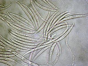 Fusarium_acuminatum_1