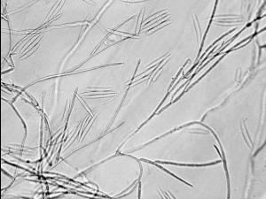 Fusarium_avenaceum_2