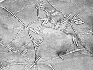 Fusarium_camptoceras_1