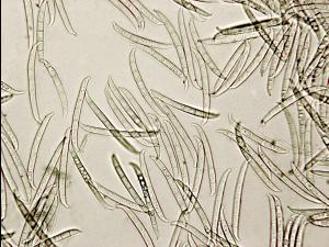 Fusarium_lateritium_1