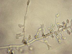 Fusarium_oxysporum_2