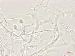 Plectosporium_tabacinum_1