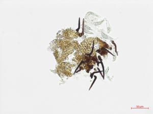 Protoventuria_myrtilli_1