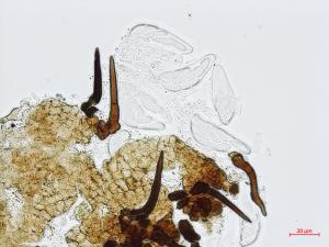 Protoventuria_myrtilli_2